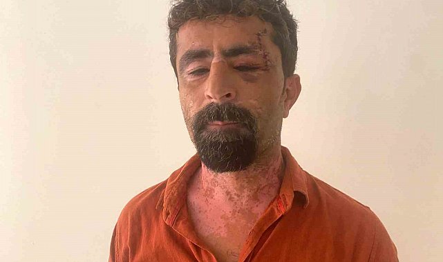 Antalya'da öfkeli damat kayınpederini hastanelik etti