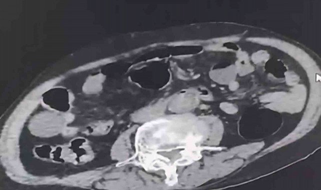 Cinsel organında Denizli'ye uyuşturucu sokmak isteyen yabancı uyruklu şahıs tutuklandı