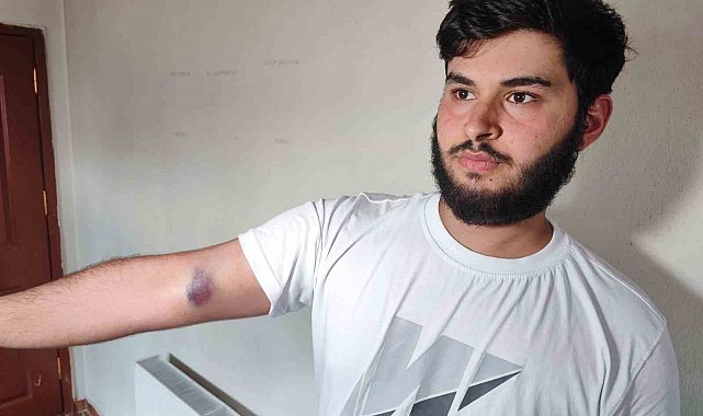 Conolar hem topu vermedi hem de aileye sopalı silahlı saldırıda bulundu