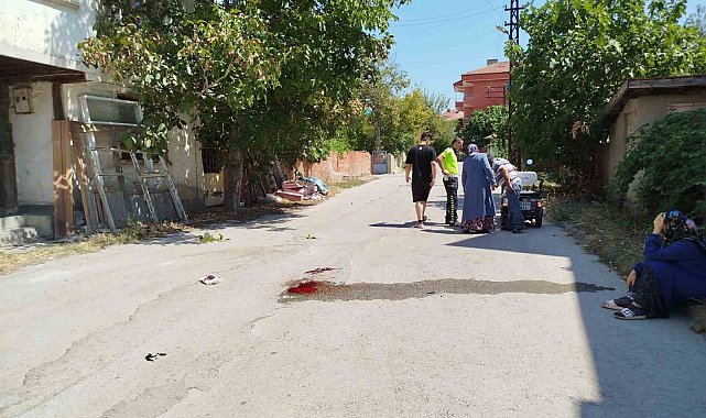 Çorum'da elektrikli motosiklet kazası: 1 yaralı