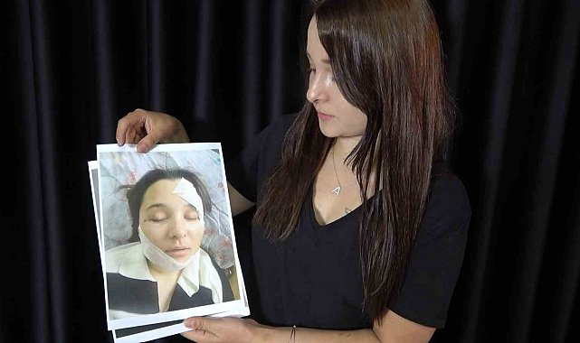 Eski sevgilisi tarafından öldüresiye darp edilen genç kadın yaşadığı kâbusu anlattı