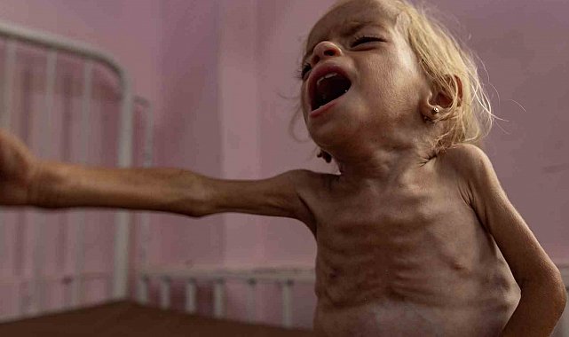 Gazze'de 3 Filistinli daha açlık nedeniyle hayatını kaybetti