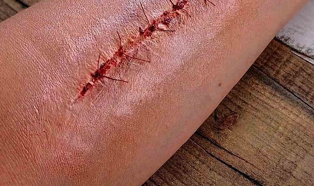 Sihirli Eller Antalya'dan setlere uzanıyor