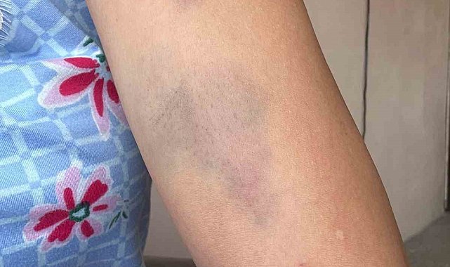 Veteriner ve ailesine 'Sokak köpeklerini besledin' dayağı iddiası