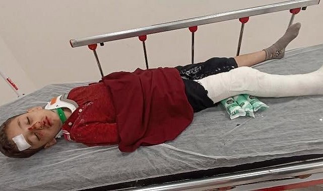 Başakşehir'de 8 yaşındaki çocuğa trafiğe kapalı alanda motosiklet çarptı: Baba yardım istedi