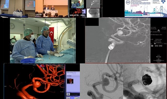 Canlı yayında zorlu beyin ameliyatı