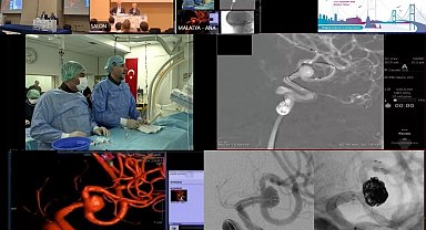 Canlı yayında zorlu beyin ameliyatı