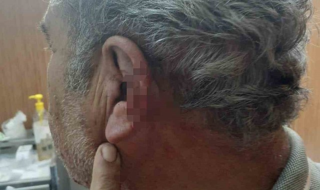 Doktor ile emekli öğretmenin mesai kavgası karakolda bitti