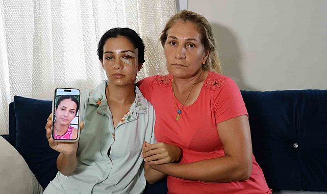 Eski eşinden şiddet gören kadın: "Ben yaşarken kurtulayım, öldükten sonra değil"