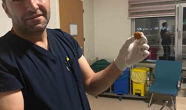 Ağrı'da yuttuğu ceviz yemek borusundan çıkarıldı