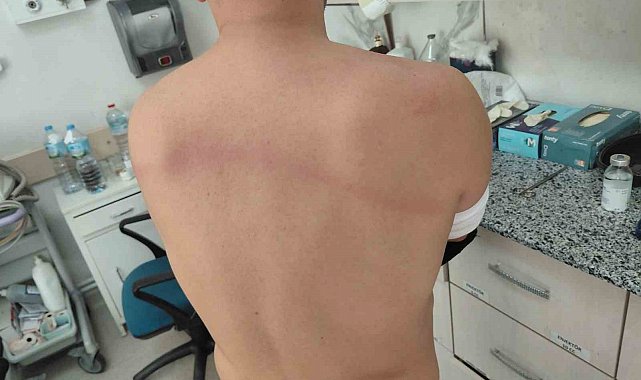 CHP'li dayakçı başkan hakkında 'Silahla kasten yaralamadan' iddianame hazırlandı