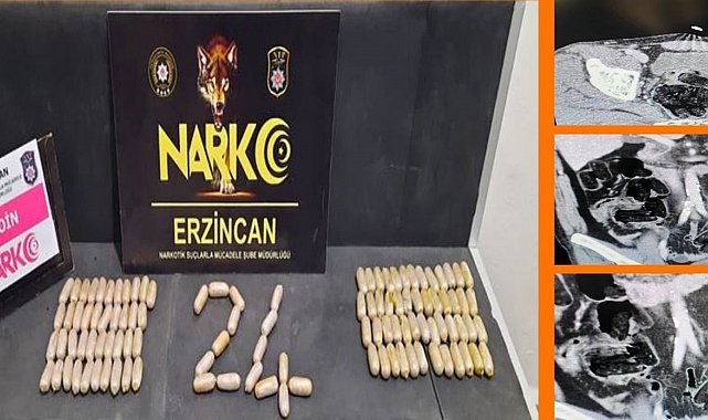 Erzincan polisinden çarpıcı operasyon: Midelerinde 109 ölüm kapsülü