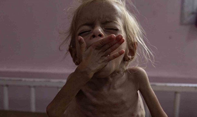 Gazze'de 2 kişi daha açlıktan hayatını kaybetti