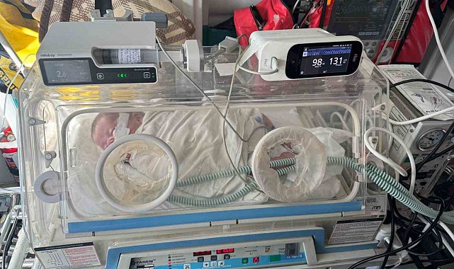 Kerem bebek, hava yolu ile Karabük'e sevk edilerek tedavi altına alındı