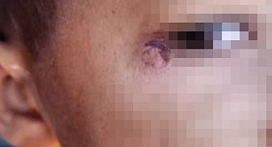 Öğrencinin yüzünde sigara söndüren temizlik görevlisi tutuklandı