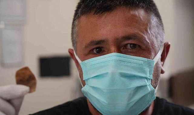 Protez gözü hayatını kabusa çevirdi