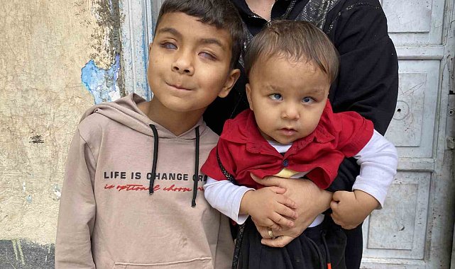 Tedaviyle dünyanın renklerini ilk defa gören 2 kardeş, başka hastalara da umut oldu