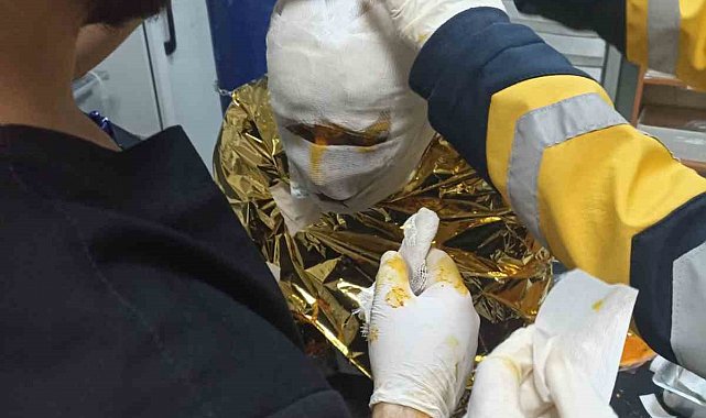 Erzincan'da kömür ocağında yangın: 2 işçi yaralı