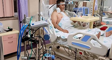 Kalp ameliyatında ECMO başarısı, bir ilk oldu