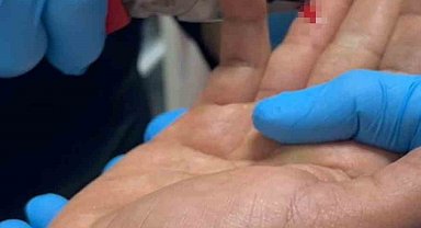 Balık macerası hastanede bitti: Parmağına saplanan olta iğnesini itfaiye çıkarttı