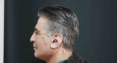 Bitlis'te ilk defa yüz germe ameliyatı başarıyla yapıldı