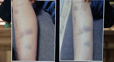 Diyarbakır'da özel okulda 8 yaşındaki çocuğun darbedildiği iddiası