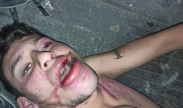 Hamam böceği yedirilen gencin dosyasında karar: Yağmadan beraat, hürriyeti tehditten 6 yıl 12 ay ceza