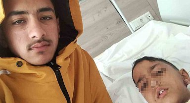 Ankara'da sokak köpeğinin saldırısına uğrayan çocuk yaralandı