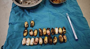 Midesinde taşıdığı uyuşturucu maddeler polisin dikkatinden sayesinde ele geçirildi