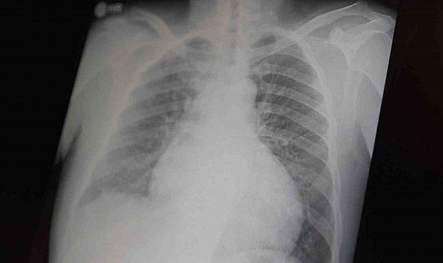 Profesör açıkladı: "Metamfetamin ve kokain gençler arasında tehlikeli boyutlara ulaştı"