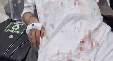 Şanlıurfa'da 72 yaşındaki adamı öldüresiye döven 4 şüpheli tutuklandı