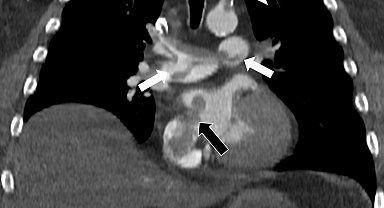 Tekden'de başarılı çalışmalara imza atan radyoloji uzmanından hayati tespit