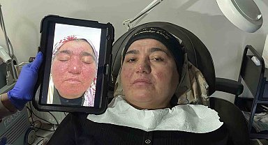 Hastalığı yüzünden yıllarca evden çıkamadı, şimdi ise çekinmeden çıkabiliyor