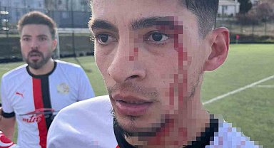 Maç sonrası saha içi savaş alanına döndü, 3 futbolcu hastanelik oldu