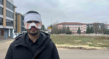 Rehber öğretmenin yüzüne sıcak çay fırlattığı fizik öğretmeni feci şekilde yandı