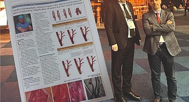 Türk kalp cerrahı Doç Dr. Yakut ve ekibinden uluslararası başarı