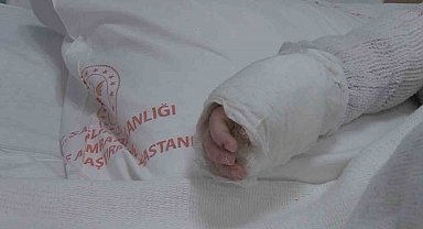 Üzerine kaynar su dökülen bebeğin vücudunun yüzde 27'si yandı