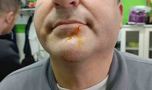 Zonguldak'ta 3. Lig maçı sonrası gerginlik: 2 gazeteci darbedildi, 2 polis yaralandı