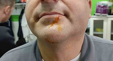 Zonguldak'ta 3. Lig maçı sonrası gerginlik: 2 gazeteci darbedildi, 2 polis yaralandı