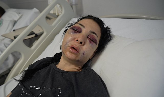 Anne ve oğlunun darp edilmesine ilişkin gözaltına alınan 3 şüpheliden 1'i tutuklandı