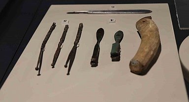 Denizli'de Antik Tıp Aletleri Sergisi yoğun ilgi gördü