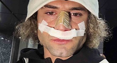 Elazığspor'da Fuat Bavuk'un burnu kırıldı