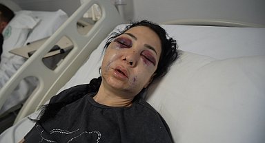 Oğlunun gözü önünde anneyi öldüresiye dövdüler: "'Küfür etmeyin' dedik diye bu hale geldim"