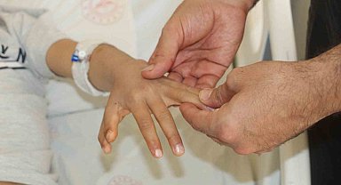 Şırnak'ta yapışık parmaklı iki kardeş ameliyatla sağlıklarına kavuştu