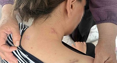 17 bıçak darbesi aldı, ölü numarasıyla kurtuldu, kocasının en ağır cezayı almasını istedi