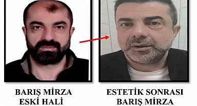 Ameliyat ile yüzünü değiştiren firari cinayet zanlısı, 7 yıl sonra yakalandı