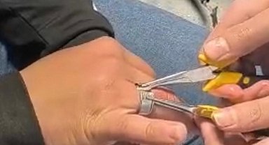 Batman'da parmağa sıkışan yüzük itfaiye ekiplerince çıkarıldı