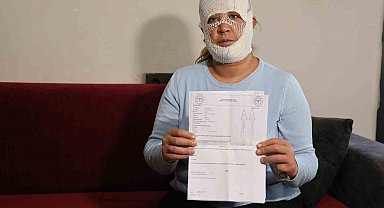 Güzelleşmek uğruna gittiği merkezde yüzü yandı