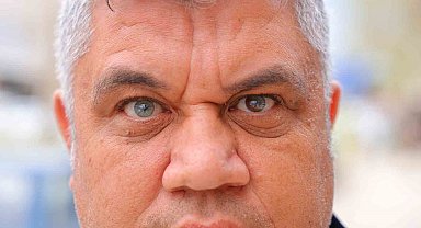 Kahramanmaraşlı adam 3 renkli gözleriyle görenlerin ilgisini çekiyor