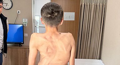 Kırgızistanlı genç şifayı Türk hekimlerinde buldu